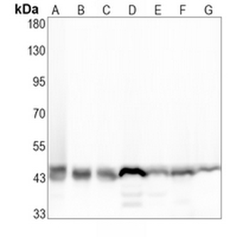 HDJ2 Rabbit Monoclonal Antibody