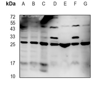 HPCA Rabbit Monoclonal Antibody