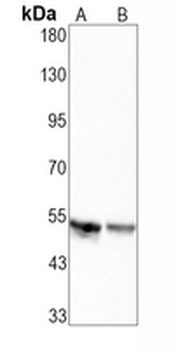 KIM1 Rabbit Monoclonal Antibody