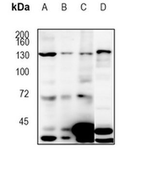 Jumonji Rabbit Monoclonal Antibody
