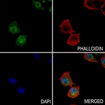 Stanniocalcin 1 Rabbit Monoclonal Antibody