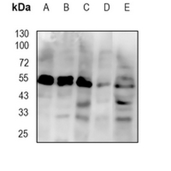 CHRNA5 Rabbit Monoclonal Antibody