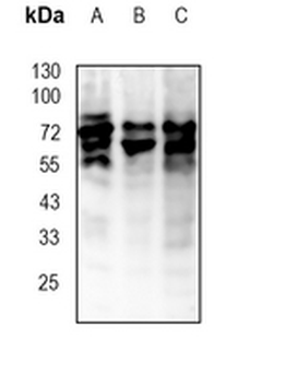 RYK Rabbit Monoclonal Antibody