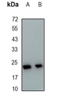 UBE2C Rabbit Monoclonal Antibody