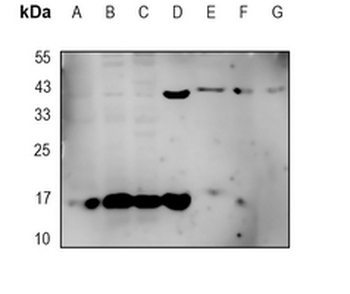 GDF3 Rabbit Monoclonal Antibody