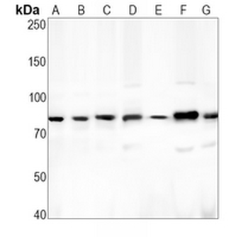 CD265 Rabbit Monoclonal Antibody