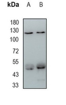UPF1 Rabbit Monoclonal Antibody