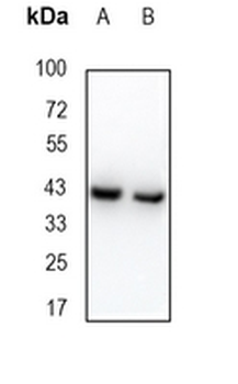MBNL1 Rabbit Monoclonal Antibody