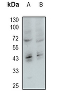 Heparanase Rabbit Monoclonal Antibody