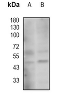 RAD52 Rabbit Monoclonal Antibody