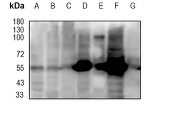 EN1 Rabbit Monoclonal Antibody