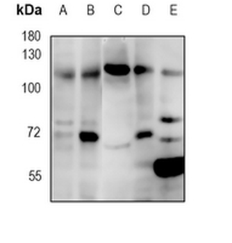 MIB1 Rabbit Monoclonal Antibody