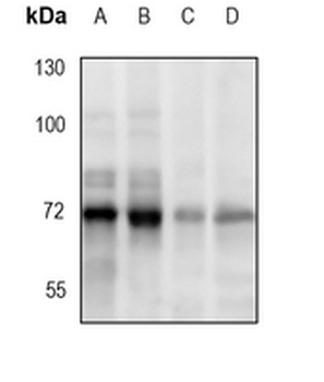 PIAS1 Rabbit Monoclonal Antibody