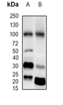 GLUR4 Rabbit Monoclonal Antibody
