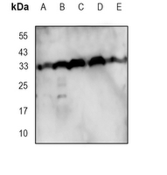 STX1B Rabbit Monoclonal Antibody
