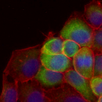 HTRA1 Rabbit Monoclonal Antibody