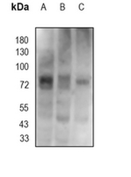 DCP1A Rabbit Monoclonal Antibody