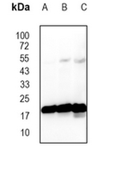 TOM22 Rabbit Monoclonal Antibody