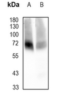 GAT1 Rabbit Monoclonal Antibody