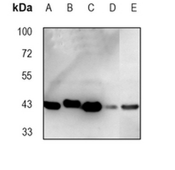 Oxytocin Receptor Rabbit Monoclonal Antibody