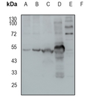 MEIS2 Rabbit Monoclonal Antibody