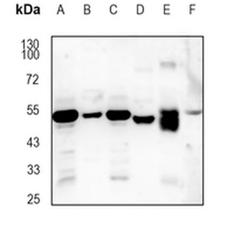 Cytochrome P450 26A1 Rabbit Monoclonal Antibody