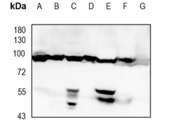 VPS35 Rabbit Monoclonal Antibody