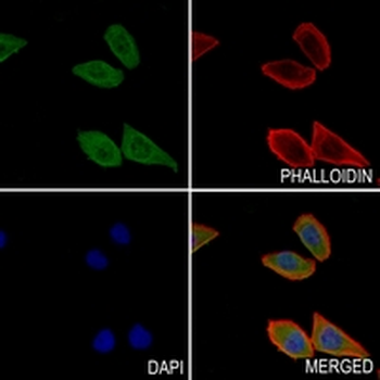 VPS35 Rabbit Monoclonal Antibody