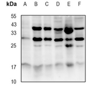 CTRL Rabbit Monoclonal Antibody