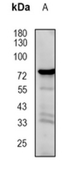 ALOX12 Rabbit Monoclonal Antibody