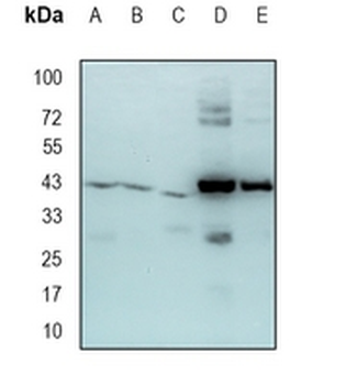 DEK Rabbit Monoclonal Antibody