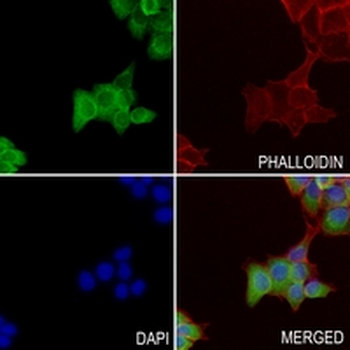 GABRB1 Rabbit Monoclonal Antibody