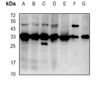Gemin2 Rabbit Monoclonal Antibody