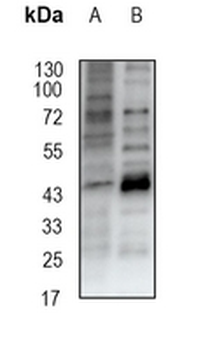 Alpha-galactosidase A Rabbit Monoclonal Antibody