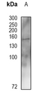 TSC1 Rabbit Monoclonal Antibody