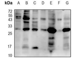 Presenilin 1 Rabbit Monoclonal Antibody