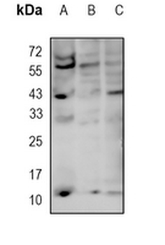 TCTEX-1 Rabbit Monoclonal Antibody