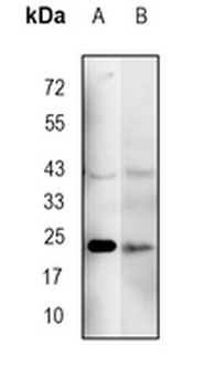 PMF-1 Rabbit Monoclonal Antibody