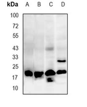 UFC1 Rabbit Monoclonal Antibody