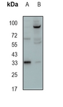 NTHL1 Rabbit Monoclonal Antibody