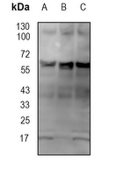 PRPF31 Rabbit Monoclonal Antibody