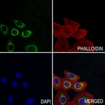 CECR5 Rabbit Monoclonal Antibody