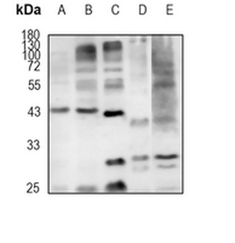KCTD9 Rabbit Monoclonal Antibody