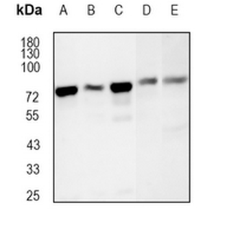 hnRNP M Rabbit Monoclonal Antibody