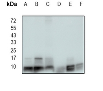 ATP5G1 Rabbit Monoclonal Antibody