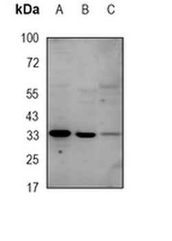 UCP1/3 Rabbit Monoclonal Antibody