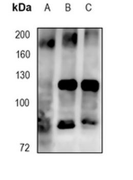 IRS2 Rabbit Monoclonal Antibody