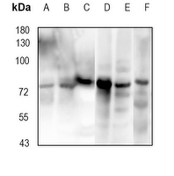 GRK3 Rabbit Monoclonal Antibody