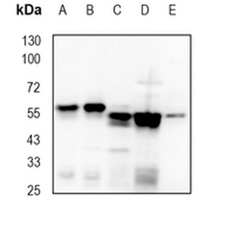 Importin alpha 2 Rabbit Monoclonal Antibody