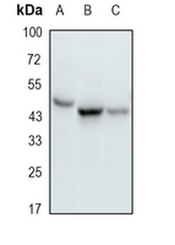 RRM2 Rabbit Monoclonal Antibody